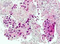 Děložní čípek po ozáření