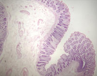 Epiteliální střevní buňky