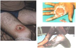 Pohled na projevy deterministických biologických účinků ionizujícího záření 