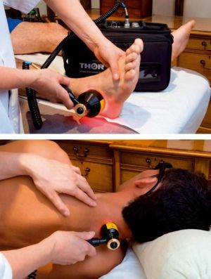 Aplikace terapeutického laseru